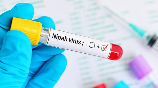 Nipha virus